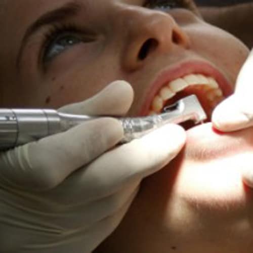 A dental professional in gloves uses a dental tool in the mouth of a patient. The patients mouth is open, and natural light illuminates the scene, focusing on the dental procedure.